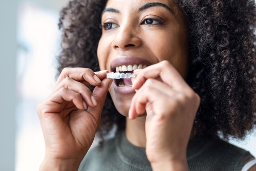 Clear Aligners en Wayne, NJ | Reserve una Consulta Gratuita Hoy