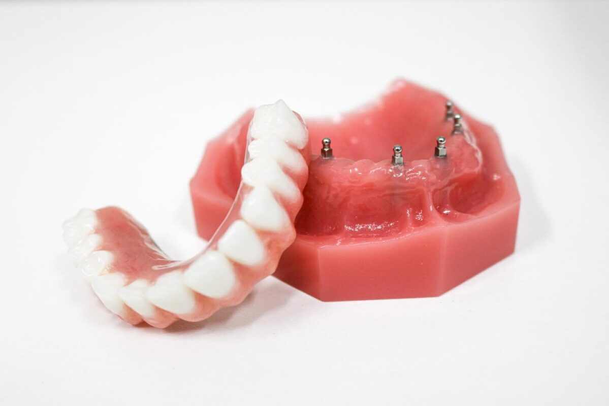 Dentaduras de Implante de Un Día en Wayne, NJ | Consultas Gratuitas