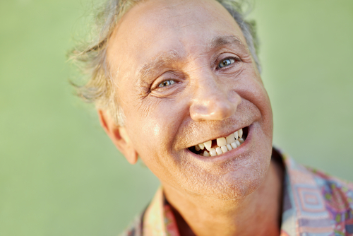 Best Implant Options in 2026 [Video Breakdown] Free Consultation